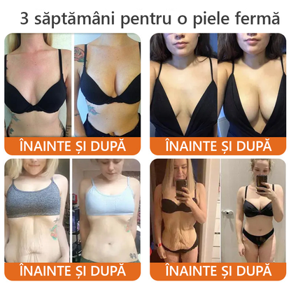 🎁🐝 Crema regeneratoare Sinvie® cu venin de albine 🔥– 50 ml🎁