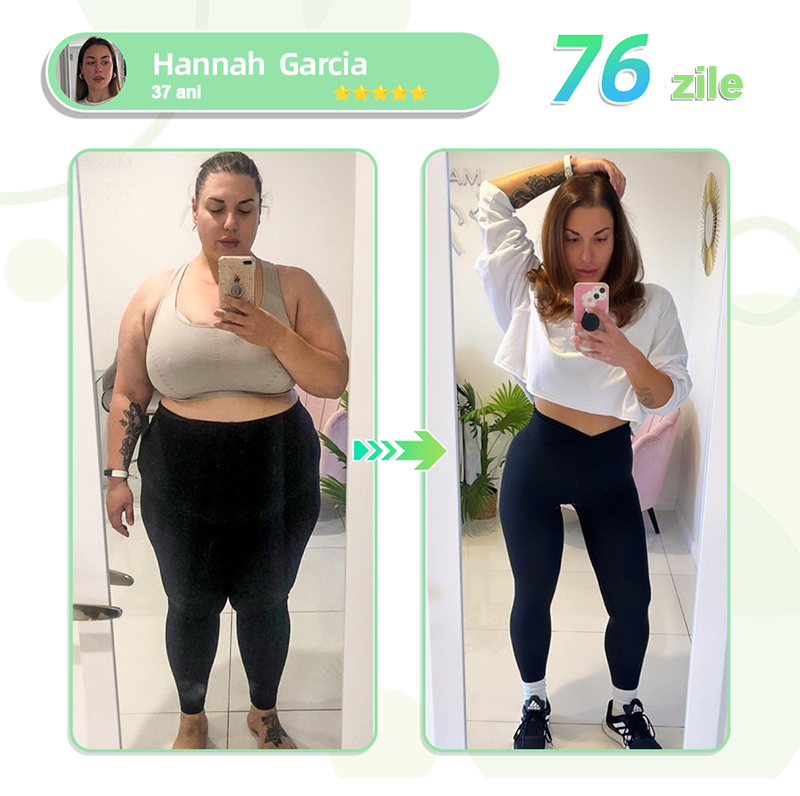 🎁【Vezi rezultatele după 7 zile】🌲Voilaist® plasture nano cu microace SMGT-GLP-1 (Fără durere, cu efect de lungă durată, tratează diabetul, obezitatea și bolile cardiovasculare)🎁